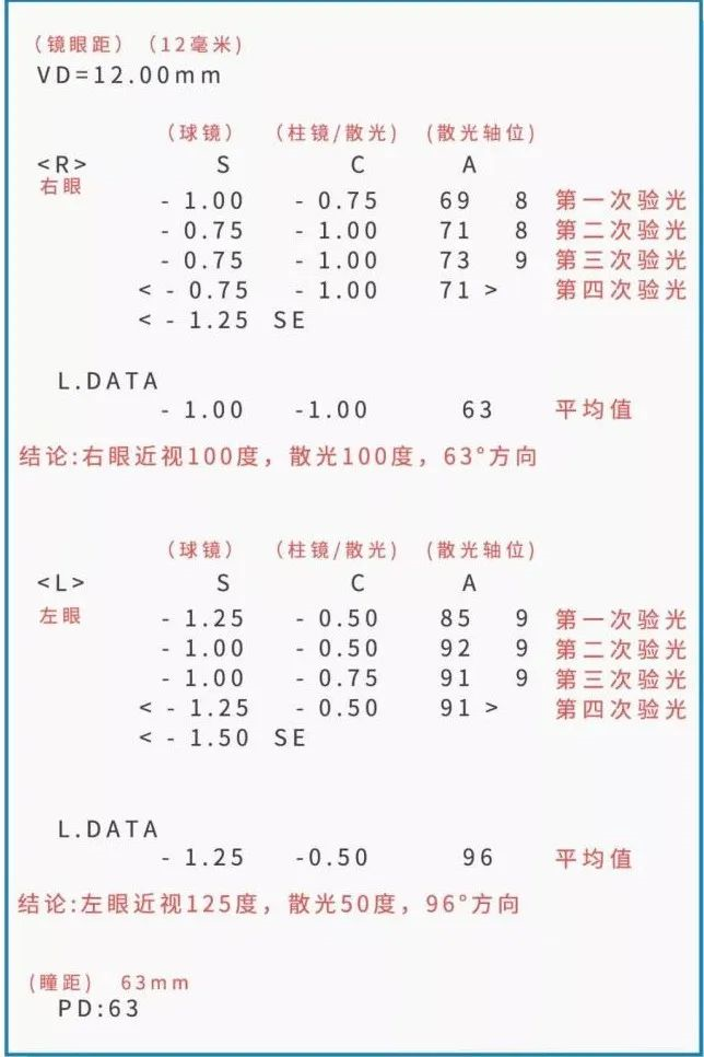 建議收藏！眼睛驗光報告單這樣看！