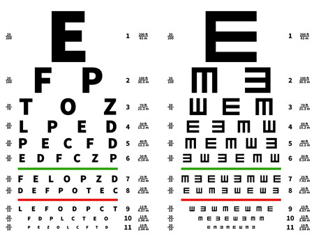 高考,近視手術,優惠,摘鏡,近視術前檢查