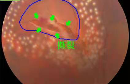 別小瞧這類影子，它很有可能對人們的眼鏡身心健康挺大傷害!