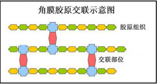 青少年近視,兒童近視,OK鏡,惠州希瑪眼科醫(yī)院