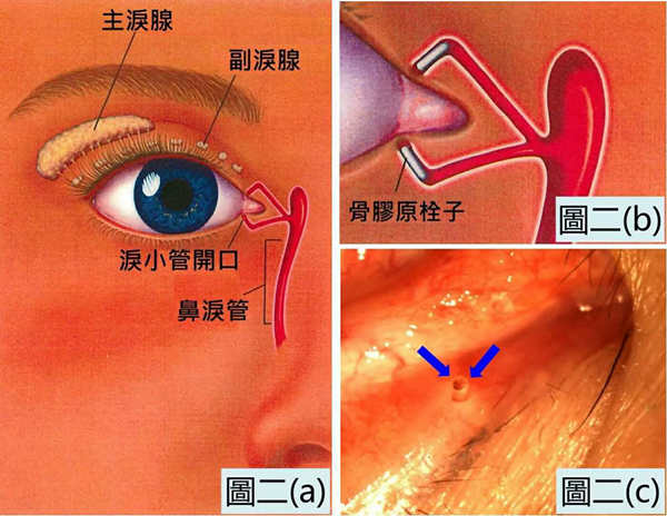 干眼癥,眼睛干澀,眼干癥,惠州希瑪眼科醫(yī)院